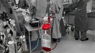 Autologous blood filtering peri- and postoperative